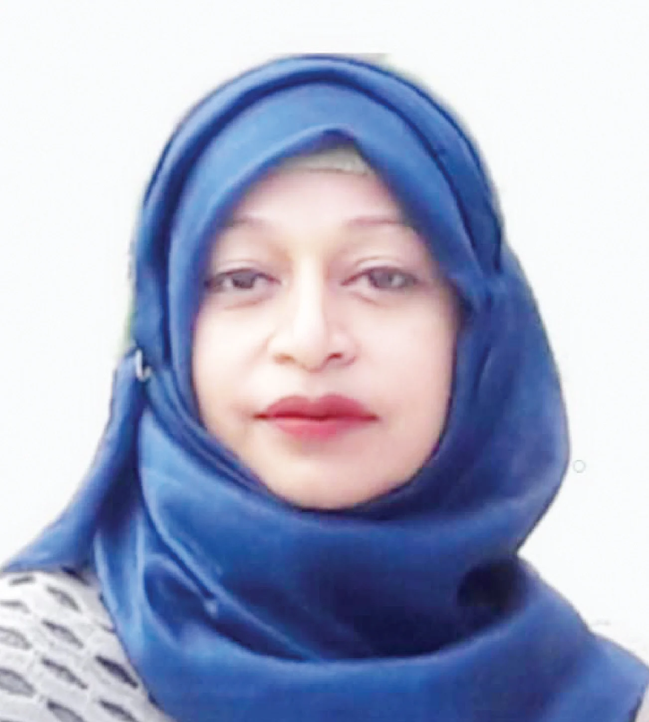 Dr. Riffat Rashid, Consultant, Department of Oculoplastic & Orbits, Ispahani Islamia Eye Institute and Hospital, Dhaka.
